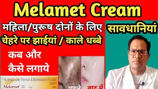 Melamet Cream  Melasma  Uses  Side effects  Review  Melamet Cream Remove Pigmentation [upl. by Annoet180]