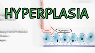 Hyperplasia  Physiological vs Pathological  Explained in 2 Minutes [upl. by Atsillak]