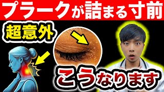 『血栓』が詰まる直前にだけ出る危険サイン、必ずこうなります。【なぜ報道しない？】 [upl. by Adnale]