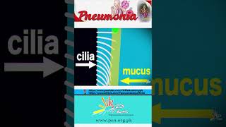 Pneumonia I Pneumonia Detail I Gaseous Exchange I Biology I penacademy biology pneumonia [upl. by Amoreta]