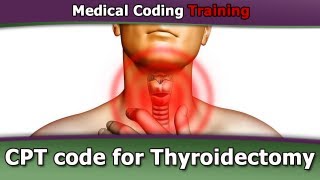 CPT Code for Thyroidectomy — CPT Coding Guidelines [upl. by Assillem]