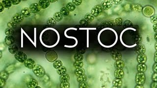 Nostoc under microscopealgaecutiegirl0023 [upl. by Shamrao]