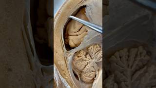 Incredible Tissue Surrounding Your Brain  Institute of Human Anatomy [upl. by Blankenship]