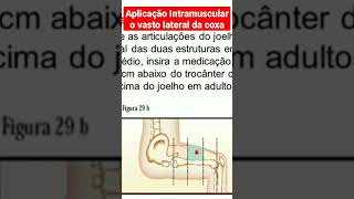 Aplicação Intramuscular no vasto lateral da coxa [upl. by Adhern575]