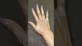 Chemical Peel On knees And Hands clearstemskincare ytshorts sristydutta [upl. by Lebatsirc]