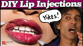 LIP FILLERS at HOME  DIY Lip Fillers [upl. by Leffert]