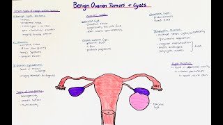 Benign Ovarian Tumors  Ovarian Cysts  histology  clinics [upl. by Luba419]