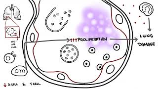 Pneumocystis jirovecii  Pneumocystis pneumonia [upl. by Osnohpla]