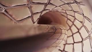 Stent coronarian  Dr Radu Pretorian  Angioplastie cu stent [upl. by Raab546]