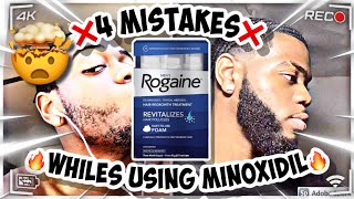 MINOXIDIL BEARD  MISTAKES WHILE USING MINOXIDIL [upl. by Akram190]