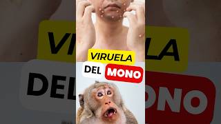 📛Descubre los Síntomas de la VIRUELA del MONO virueladelmono mpox [upl. by Newol551]