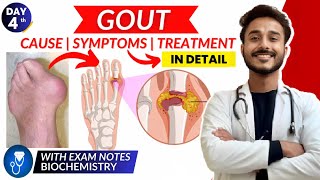 gout biochemistry  cause and symptom of gout  treatment of gout biochemistry [upl. by Leahci]