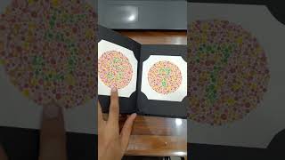 Colour Vision Test Understanding Colour Blindness Test colorblindness eyehospital eyedoctor [upl. by Emiatej]