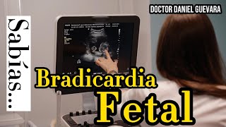 Bradicardia fetal [upl. by Ardnosak]