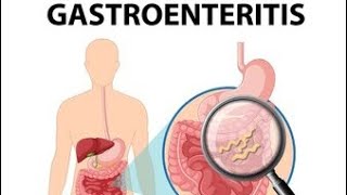 Gastroenteritis Definition of gastroenteritis Causes of gastroenteritis Symptoms💯✨ [upl. by Arim]