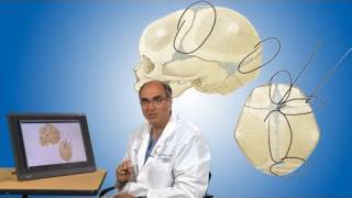 Plagiocephaly and its treatment  Boston Children’s Hospital [upl. by Olram914]