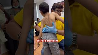 Chiropractic treatment for scoliosis drrajneeshkant [upl. by Utas]