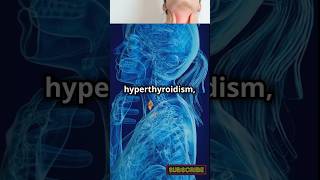 ThyroidHealth Metabolism Hypothyroidism Hyperthyroidism HealthEducation EndocrineSystem [upl. by Rihaz]