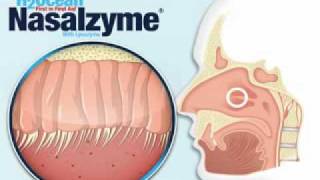 Neti Pots and Nasal irrigation simplified [upl. by Vernita]