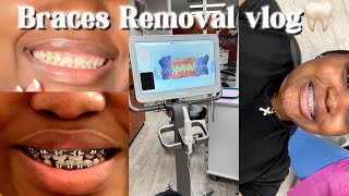 Braces Before And After Removal  No More Crooked Smile 😃 … [upl. by Norted409]