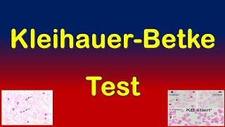 KleihauerBetke Test  How to Detect Fetal Maternal Hemorrhage [upl. by Reedy]