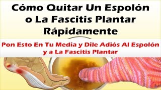 Pon Esto En Tu Media y Dile Adiós Al Espolon y a La Fascitis Plantar Como Quitar Un Espolon Rapido [upl. by Melisa]