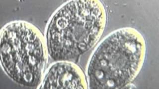 Ciliates moving detailed video [upl. by Gio]