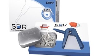 SDR et retraitement endodontique  Dentsply [upl. by Schaffel110]