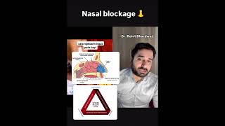 Nasal blockage in babies  noseblock nasalspray parentingtips newparenttips saline newbornbaby [upl. by Neesay]