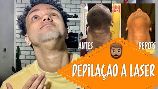 DEPILAÇÃO A LASER BARBA VALE APENA [upl. by Llerol]