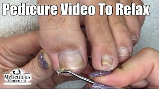 Relaxing Pedicure Toenail Cleaning No Talking Relief for Big Toenail [upl. by Ayhdiv]