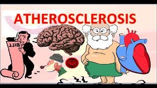 Atherosclerosis in hindi  एथेरोस्क्लेरोसिस  pathophysiology  pathogenesis [upl. by Daria398]