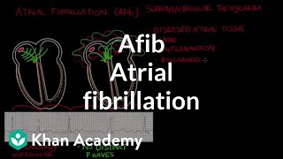 Atrial fibrillation Afib  Circulatory System and Disease  NCLEXRN  Khan Academy [upl. by Markiv]