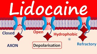 Lidocaine as Local Anesthetic [upl. by Yleak]