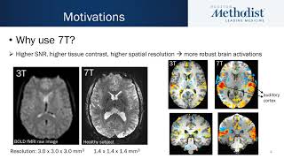 190 Can resting state reflect urodynamic testing in delineating voiding networks using fMRI [upl. by Maureen743]