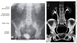 Radiographic Contrast Studies of the Urinary System [upl. by Teddman]