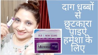 Mederma Advanced Plus Scar Gel Review amp Demo  Best Gel for Old amp New Scars  Womens World [upl. by Skyler441]