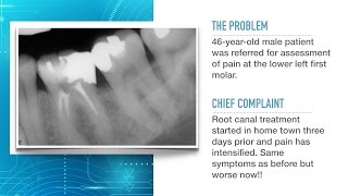 Advances in Endodontic Treatment Part 1Diagnosis and Treatment Planning [upl. by Creamer]