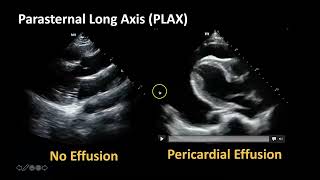 🫀❤️🧑🏻‍⚕️2D ECHO  EJECTION FRACTION EFFUSIONS EQUALITYRV STRAIN in A4C PLAX PSAX SX VIEWS [upl. by Atworth467]