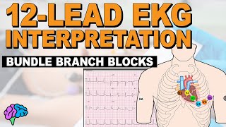 Bundle Branch Blocks MADE EASY  12 Lead EKG [upl. by Oramlub248]