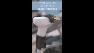 Do You Have Rosacea [upl. by Dosh]