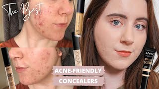 Best Concealers For ACNE PRONE SKIN  Scarring amp Pigmentation  NonComdogenic [upl. by Akinahc261]