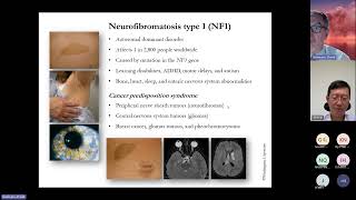 20241016 Neurofibromatosis [upl. by Galligan]