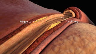 LDL and HDL Cholesterol  Good and Bad Cholesterol  Nucleus Health [upl. by Efar536]