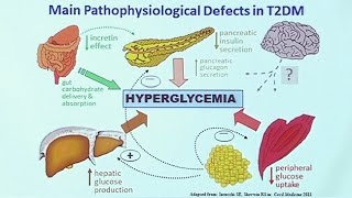 Making Sense of Diabetic Medications [upl. by Nomsed]