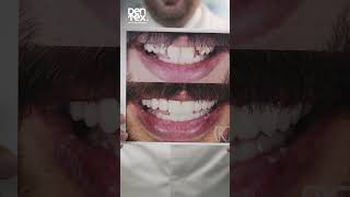 dentex اكسبلور dentist من هو الدكتور خليل [upl. by Dimmick]