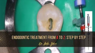 Root canal treatment from A to Z Step by Step [upl. by Lehcir]