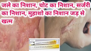 contractubex gel का use चोट निशान जले का निशान ओर किसी भी प्रकार के निशान को जड़ से खत्म [upl. by Terry745]