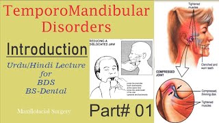 TMJDisorderTemporomandibular DisordersMaxillofacial surgeryUrduHindi Lecture for BDSBsDental [upl. by Refinnaj]