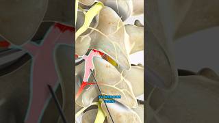 Selective nerve root block 3D Animation [upl. by Blood800]